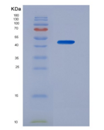 小鼠脂蛋白关联磷脂酶A2(LpPLA2)重组蛋白