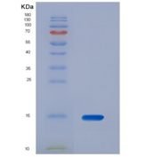 人粘蛋白2(MUC2)重组蛋白