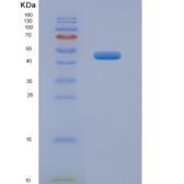 人中性粒细胞弹性蛋白酶(NE)重组蛋白