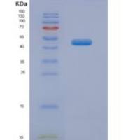 人中性粒细胞弹性蛋白酶(NE)重组蛋白