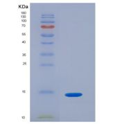小鼠血小板衍生生长因子B(PDGFB)重组蛋白