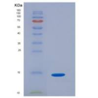 小鼠血小板衍生生长因子B(PDGFB)重组蛋白