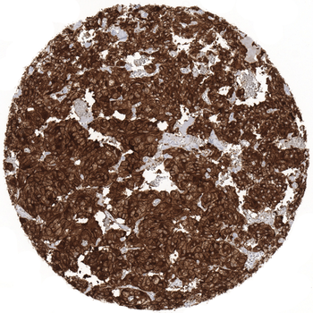 NSE gamma antibody 抗体，orb22765