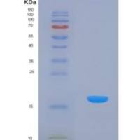 人白介素24(IL24)重组蛋白