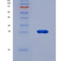 人载脂蛋白B100(APOB100)重组蛋白