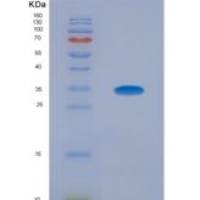 人苯丙氨酰tRNA合成酶α(FARSa)重组蛋白