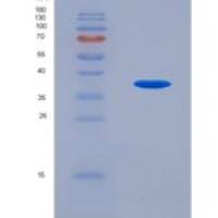 人周期素依赖性激酶13(CDK13)重组蛋白