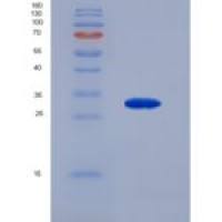 人连环蛋白α1(CTNNa1)重组蛋白