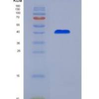 小鼠玻连蛋白(VTN)重组蛋白