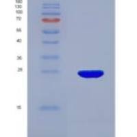 小鼠囊性纤维化跨膜传导调节因子(CFTR)重组蛋白