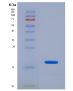 人P选择素(SELP)重组蛋白