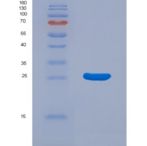 大鼠丝氨酸蛋白酶1(PRSS1)重组蛋白