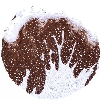 Cytokeratin 14 antibody 抗体，orb