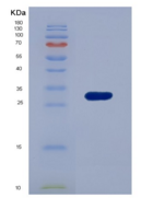 大鼠组织蛋白酶S(CTSS)重组蛋白