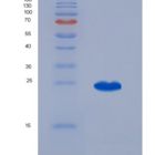大鼠脂质运载蛋白2(NGAL)重组蛋白