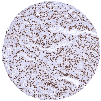 Transcription factor E3 / TFE3