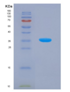人沉默调节蛋白4(SIRT4)重组蛋白