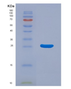 大鼠丝氨酸蛋白酶1(PRSS1)重组蛋白
