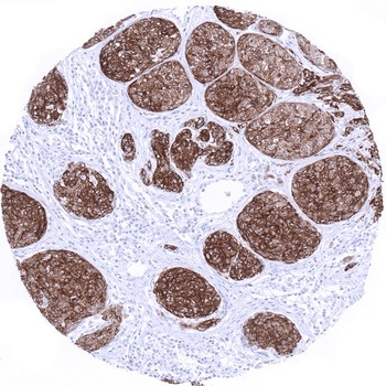 Melan A CR (Cross Reactive) an