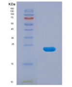 小鼠α白蛋白(AFM)重组蛋白