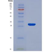 人解整合素金属蛋白酶17(ADAM17)重组蛋白