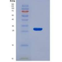 人解整合素金属蛋白酶17(ADAM17)重组蛋白