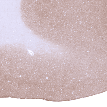 GAD2 / GAD65 antibody 抗体，orb22