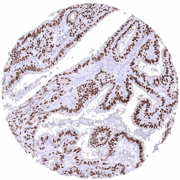 Estrogen Receptor antibody 抗体，