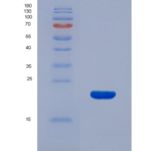 大鼠表皮生长因子受体(EGFR)重组蛋白