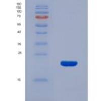 大鼠表皮生长因子受体(EGFR)重组蛋白