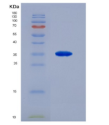 人C-Ros癌基因1，受体酪氨酸激酶重组蛋白