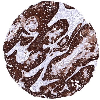 Cytokeratin 14 antibody 抗体，orb