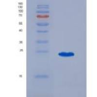 人妊娠关联血浆蛋白A(PAPPA)重组蛋白