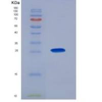 小鼠朊病毒蛋白(PRNP)重组蛋白