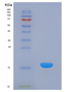 大鼠角蛋白1(CK1)重组蛋白