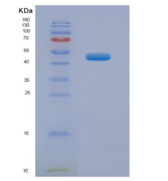 人中性粒细胞弹性蛋白酶(NE)重组蛋白