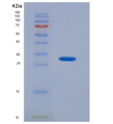人胰岛素受体(INSR)重组蛋白