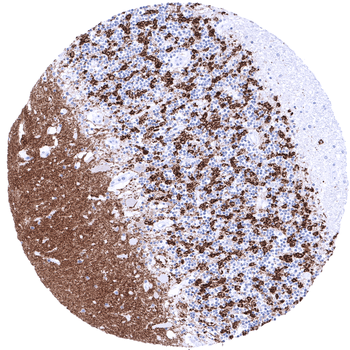 Synaptophysin antibody 抗体，orb2