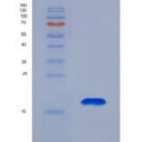 人层粘连蛋白α1(LAMA1)重组蛋白