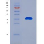 人CREB结合蛋白(CREBBP)重组蛋白