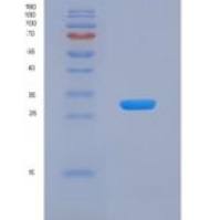人凝血因子Ⅸ(F9)重组蛋白
