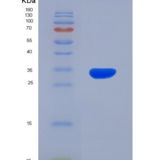 大鼠结缔组织生长因子(CTGF)重组蛋白