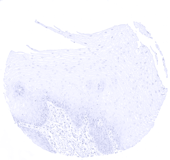 Cytokeratin 10 antibody 抗体，orb