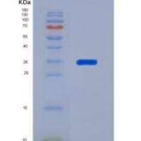 人甲状腺结合球蛋白(TBG)重组蛋白