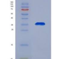 小鼠促性腺激素释放激素受体(GnRHR)重组蛋白