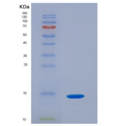 小鼠血小板衍生生长因子B(PDGFB)重组蛋白