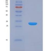 人腺苷高半胱氨酸水解酶样蛋白1(AHCYL1)重组蛋白