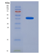 人心肌肌球蛋白结合蛋白C(MYBPC3)重组蛋白
