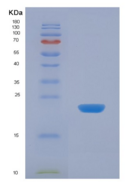 人载脂蛋白D(APOD)重组蛋白