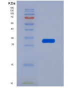 小鼠蛋白二硫化物异构酶A3(ERp57)重组蛋白